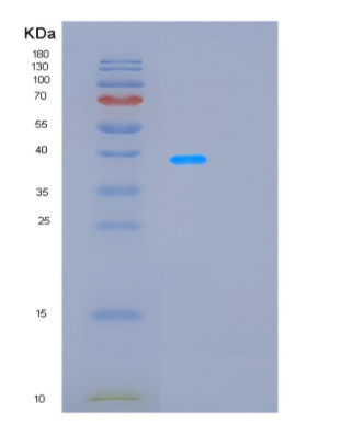 Recombinant Rat Ldha Protein,Recombinant Rat Ldha Protein