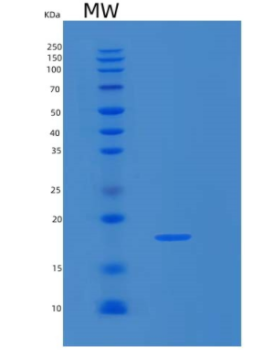 Recombinant Human LGALS13 Protein,Recombinant Human LGALS13 Protein