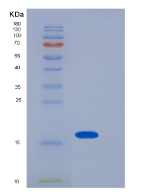 Recombinant Mouse LGALS1 Protein,Recombinant Mouse LGALS1 Protein