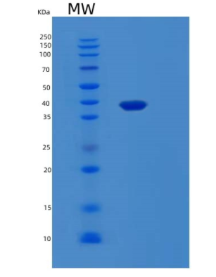 Recombinant Human LGALS8 Protein,Recombinant Human LGALS8 Protein