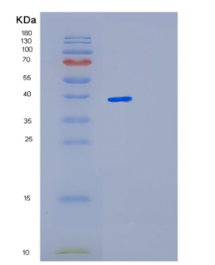 Recombinant Mouse Lgals4 Protein,Recombinant Mouse Lgals4 Protein