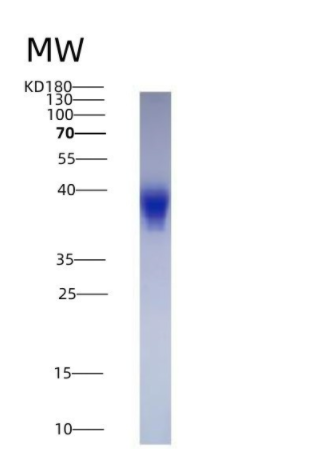 Eukaryotic Leukemia Inhibitory Factor (LIF),Eukaryotic Leukemia Inhibitory Factor (LIF)