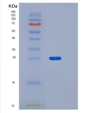 Recombinant Mouse LDLR chaperone MESD Protein,Recombinant Mouse LDLR chaperone MESD Protein