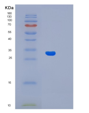 Recombinant Human Lin7A Protein,Recombinant Human Lin7A Protein