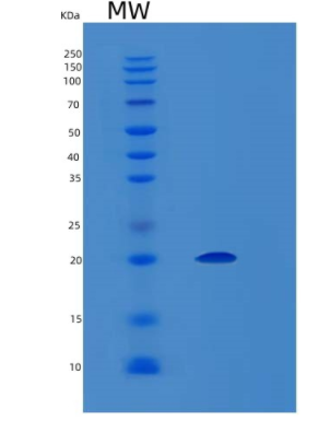 Recombinant Human LGALSL Protein,Recombinant Human LGALSL Protein