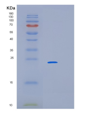 Recombinant Human LIN7C Protein,Recombinant Human LIN7C Protein