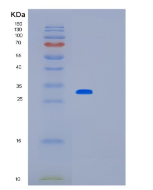 Recombinant Human LOX Protein,Recombinant Human LOX Protein