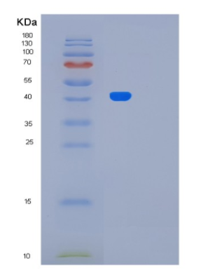 Recombinant Human LRP2BP Protein,Recombinant Human LRP2BP Protein