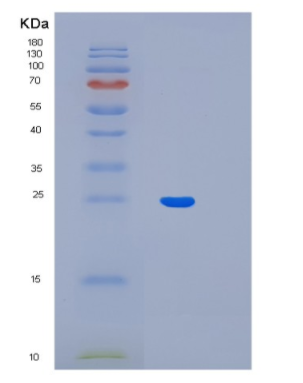 Recombinant Human LIN7B Protein,Recombinant Human LIN7B Protein