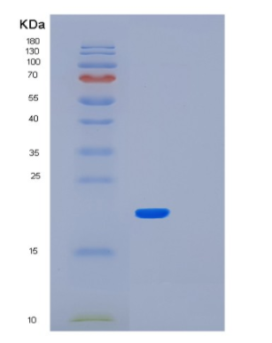 Recombinant Human LMO1 Protein,Recombinant Human LMO1 Protein