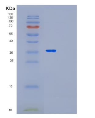 Recombinant Human LRG1 Protein,Recombinant Human LRG1 Protein