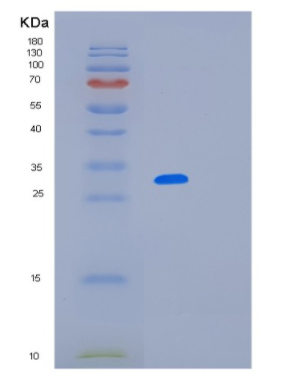 Recombinant Human LRRC59 Protein,Recombinant Human LRRC59 Protein