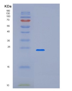 Recombinant Human LSM12 Protein,Recombinant Human LSM12 Protein