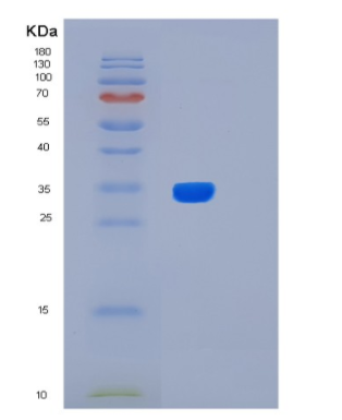 Recombinant Human Livin beta Protein,Recombinant Human Livin beta Protein