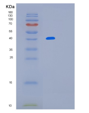 Recombinant Mouse Lrpap1 Protein,Recombinant Mouse Lrpap1 Protein