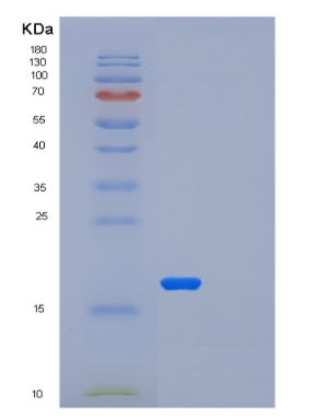 Recombinant Human LSM1 Protein,Recombinant Human LSM1 Protein