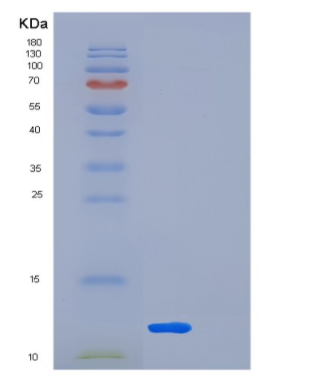 Recombinant Human LSM5 Protein,Recombinant Human LSM5 Protein