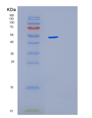 Recombinant Human LPCAT1 Protein,Recombinant Human LPCAT1 Protein