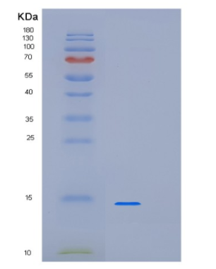 Recombinant Human LSM3 Protein,Recombinant Human LSM3 Protein