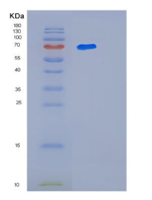 Recombinant Human LTA4H Protein,Recombinant Human LTA4H Protein