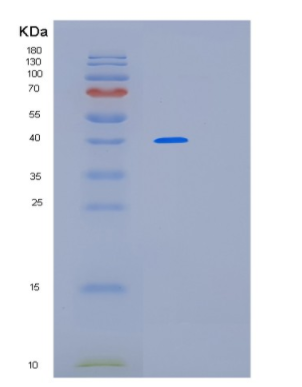 Recombinant Human LRPAP1 Protein,Recombinant Human LRPAP1 Protein