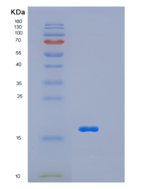 Recombinant Human LSM4 Protein,Recombinant Human LSM4 Protein