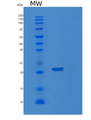 Recombinant Human LZIC Protein,Recombinant Human LZIC Protein