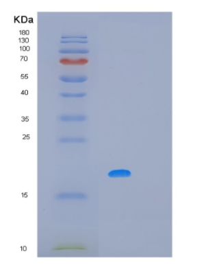 Recombinant Human MAFF Protein,Recombinant Human MAFF Protein