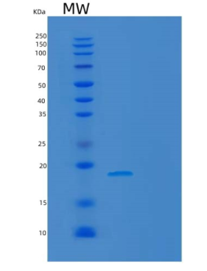 Recombinant Human MAFK Protein,Recombinant Human MAFK Protein