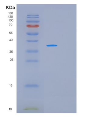 Recombinant Human MAGEA8 Protein,Recombinant Human MAGEA8 Protein