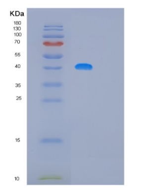 Recombinant Human MAGEB10 Protein,Recombinant Human MAGEB10 Protein