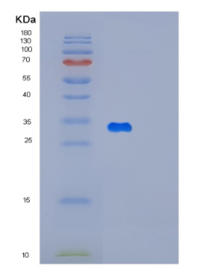 Recombinant Human MAGED1 Protein,Recombinant Human MAGED1 Protein