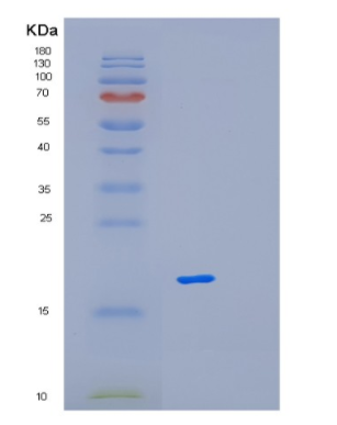 Recombinant Human MAGOH Protein,Recombinant Human MAGOH Protein