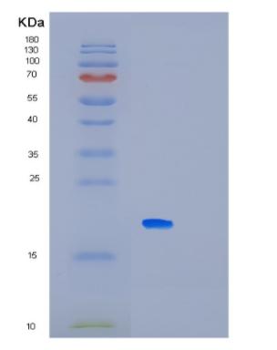 Recombinant Human MAGOHB Protein,Recombinant Human MAGOHB Protein