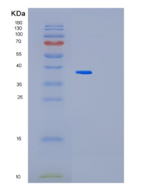 Recombinant Human MAK16 Protein,Recombinant Human MAK16 Protein