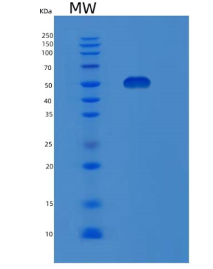 Recombinant Human MAOA Protein,Recombinant Human MAOA Protein