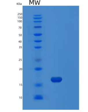 Recombinant Human MAP1LC3B Protein,Recombinant Human MAP1LC3B Protein