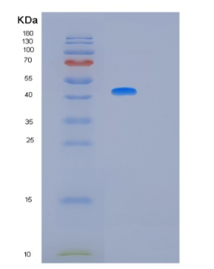 Recombinant Human MAPK11 Protein,Recombinant Human MAPK11 Protein