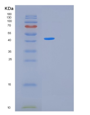 Recombinant Human MAPK12 Protein,Recombinant Human MAPK12 Protein