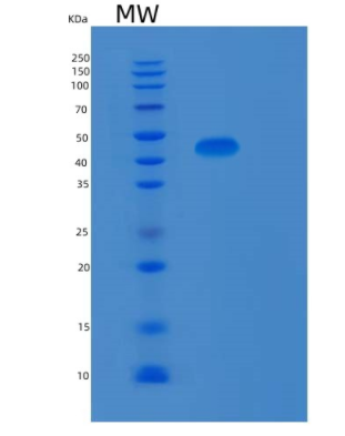 Recombinant Human MAPK9 Protein,Recombinant Human MAPK9 Protein