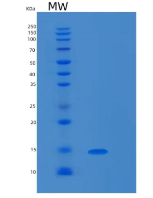 Recombinant Human MAPKSP1 Protein,Recombinant Human MAPKSP1 Protein