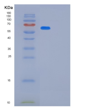 Recombinant Human MAVS Protein,Recombinant Human MAVS Protein