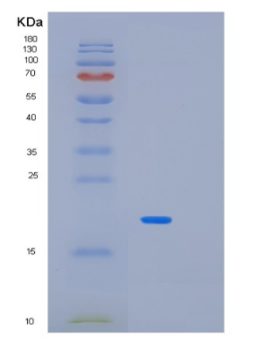 Recombinant Human MAX Protein,Recombinant Human MAX Protein