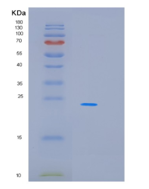 Recombinant Human MBP Protein,Recombinant Human MBP Protein