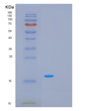 Recombinant Human MCEE Protein,Recombinant Human MCEE Protein