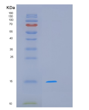 Recombinant Human MCFD2 Protein,Recombinant Human MCFD2 Protein