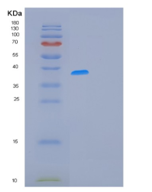 Recombinant Human MCL1 Protein,Recombinant Human MCL1 Protein