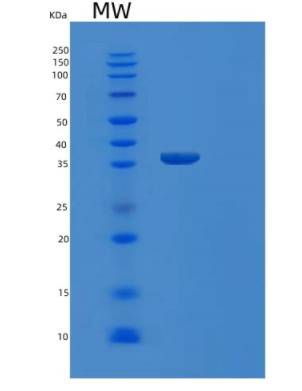 Recombinant Human MDH1 Protein,Recombinant Human MDH1 Protein