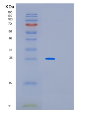 Recombinant Human MED20 Protein,Recombinant Human MED20 Protein