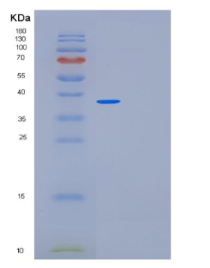 Recombinant Human MED27 Protein,Recombinant Human MED27 Protein